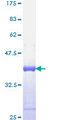 CSF1 / MCSF Protein - 12.5% SDS-PAGE Stained with Coomassie Blue