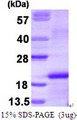 CSF1 / MCSF Protein