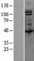 CSF1R / CD115 / FMS Protein - Western validation with an anti-DDK antibody * L: Control HEK293 lysate R: Over-expression lysate