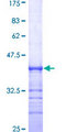 CSF1R / CD115 / FMS Protein - 12.5% SDS-PAGE Stained with Coomassie Blue.