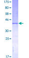 CSF2 / GM-CSF Protein - 12.5% SDS-PAGE of human CSF2 stained with Coomassie Blue