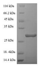 CSF2 / GM-CSF Protein - (Tris-Glycine gel) Discontinuous SDS-PAGE (reduced) with 5% enrichment gel and 15% separation gel.