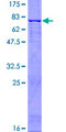 CSF2RA / CD116 Protein - 12.5% SDS-PAGE of human CSF2RA stained with Coomassie Blue