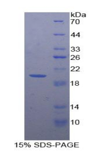 CSF2RA / CD116 Protein - Recombinant Colony Stimulating Factor 2 Receptor Alpha By SDS-PAGE