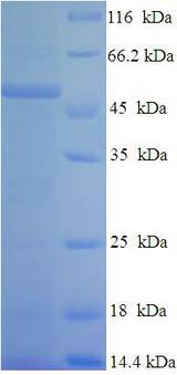 CSF2RA / CD116 Protein