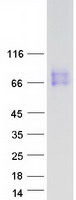 CSF2RA / CD116 Protein - Purified recombinant protein CSF2RA was analyzed by SDS-PAGE gel and Coomassie Blue Staining