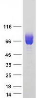 CSF2RA / CD116 Protein - Purified recombinant protein CSF2RA was analyzed by SDS-PAGE gel and Coomassie Blue Staining