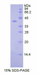 CSF2RB / CD131 Protein - Recombinant Colony Stimulating Factor 2 Receptor Beta By SDS-PAGE