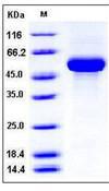 CSF2RB / CD131 Protein