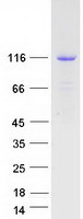 CSF2RB / CD131 Protein - Purified recombinant protein CSF2RB was analyzed by SDS-PAGE gel and Coomassie Blue Staining
