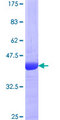CSF3 / G-CSF Protein - 12.5% SDS-PAGE of human CSF3 stained with Coomassie Blue