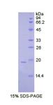 CSF3 / G-CSF Protein - Recombinant Colony Stimulating Factor 3, Granulocyte By SDS-PAGE