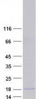 CSF3 / G-CSF Protein - Purified recombinant protein CSF3 was analyzed by SDS-PAGE gel and Coomassie Blue Staining