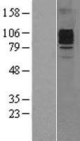 CSF3R / CD114 Protein - Western validation with an anti-DDK antibody * L: Control HEK293 lysate R: Over-expression lysate