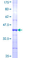 CSF3R / CD114 Protein - 12.5% SDS-PAGE Stained with Coomassie Blue.