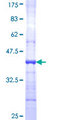 CSF3R / CD114 Protein - 12.5% SDS-PAGE Stained with Coomassie Blue.