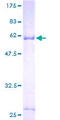 CSGALNACT1 Protein - 12.5% SDS-PAGE of human ChGn stained with Coomassie Blue