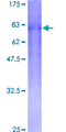 CSGALNACT2 Protein - 12.5% SDS-PAGE of human GALNACT-2 stained with Coomassie Blue