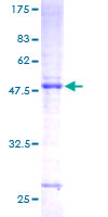 CSH1 / Placental Lactogen Protein - 12.5% SDS-PAGE of human CSH1 stained with Coomassie Blue