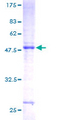 CSH1 / Placental Lactogen Protein - 12.5% SDS-PAGE of human CSH1 stained with Coomassie Blue