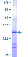 CSH1 / Placental Lactogen Protein - 12.5% SDS-PAGE Stained with Coomassie Blue.
