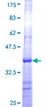 CSH1 / Placental Lactogen Protein - 12.5% SDS-PAGE Stained with Coomassie Blue.
