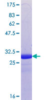 CSMD3 Protein - 12.5% SDS-PAGE Stained with Coomassie Blue.