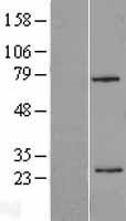 CSN2 / Beta Casein Protein - Western validation with an anti-DDK antibody * L: Control HEK293 lysate R: Over-expression lysate