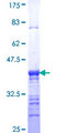 CSN2 / Beta Casein Protein - 12.5% SDS-PAGE Stained with Coomassie Blue.
