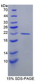 CSN2 / Beta Casein Protein - Recombinant  Casein Beta By SDS-PAGE
