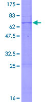 CSNK1A1 / CK1 Alpha Protein - 12.5% SDS-PAGE of human CSNK1A1 stained with Coomassie Blue