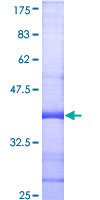 CSNK1A1 / CK1 Alpha Protein - 12.5% SDS-PAGE Stained with Coomassie Blue.