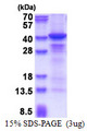 CSNK1A1 / CK1 Alpha Protein
