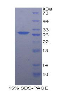 CSNK1A1 / CK1 Alpha Protein - Recombinant Casein Kinase 1 Alpha 1 By SDS-PAGE