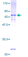 CSNK1A1L Protein - 12.5% SDS-PAGE of human CSNK1A1L stained with Coomassie Blue