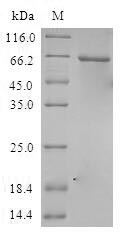 CSNK1A1L Protein - (Tris-Glycine gel) Discontinuous SDS-PAGE (reduced) with 5% enrichment gel and 15% separation gel.