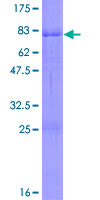 CSNK1D Protein - 12.5% SDS-PAGE of human CSNK1D stained with Coomassie Blue
