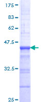 CSNK1D Protein - 12.5% SDS-PAGE Stained with Coomassie Blue.