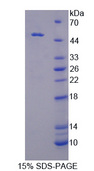 CSNK1D Protein - Recombinant Casein Kinase 1 Delta By SDS-PAGE
