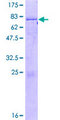 CSNK1E / CK1 Epsilon Protein - 12.5% SDS-PAGE of human CSNK1E stained with Coomassie Blue