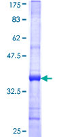 CSNK1E / CK1 Epsilon Protein - 12.5% SDS-PAGE Stained with Coomassie Blue.