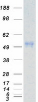 CSNK1E / CK1 Epsilon Protein - Purified recombinant protein CSNK1E was analyzed by SDS-PAGE gel and Coomassie Blue Staining