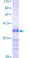 CSNK1G1 / CKI-Gamma 1 Protein - 12.5% SDS-PAGE Stained with Coomassie Blue.