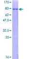 CSNK1G2 / CKI-Gamma 2 Protein - 12.5% SDS-PAGE of human CSNK1G2 stained with Coomassie Blue