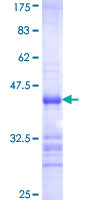 CSNK1G2 / CKI-Gamma 2 Protein - 12.5% SDS-PAGE Stained with Coomassie Blue.
