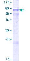 CSNK1G3 / CKI-Gamma 3 Protein - 12.5% SDS-PAGE of human CSNK1G3 stained with Coomassie Blue