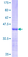 CSNK1G3 / CKI-Gamma 3 Protein - 12.5% SDS-PAGE Stained with Coomassie Blue.