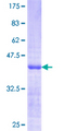 CSNK1G3 / CKI-Gamma 3 Protein - 12.5% SDS-PAGE Stained with Coomassie Blue.