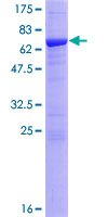 CSNK2A1 Protein - 12.5% SDS-PAGE of human CSNK2A1 stained with Coomassie Blue