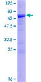 CSNK2A1 Protein - 12.5% SDS-PAGE of human CSNK2A1 stained with Coomassie Blue